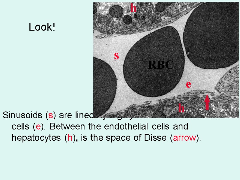 Look! Sinusoids (s) are lined by highly fenestrated endothelial cells (e). Between the endothelial